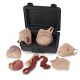Kit de heridas neonatales