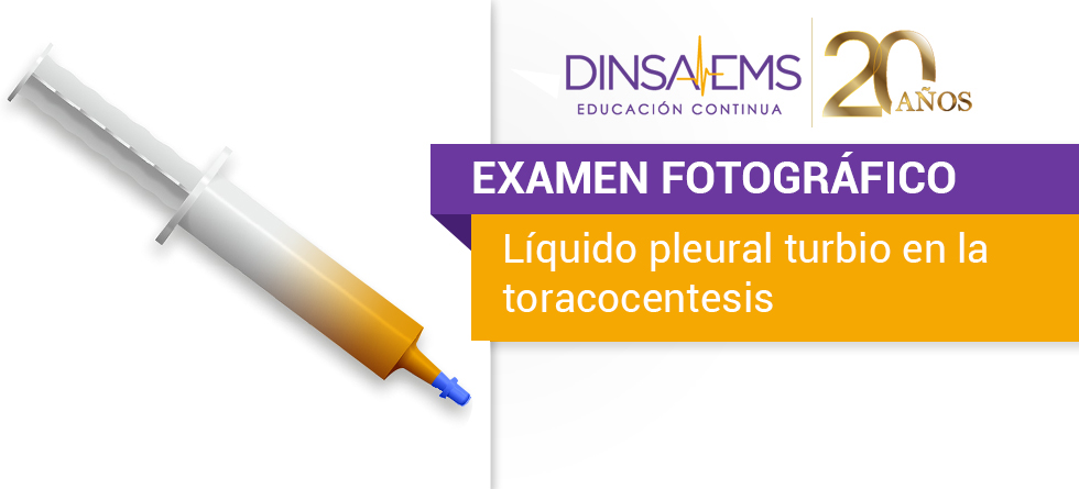 Líquido Pleural turbio en la toracocentesis | Examen fotográfico