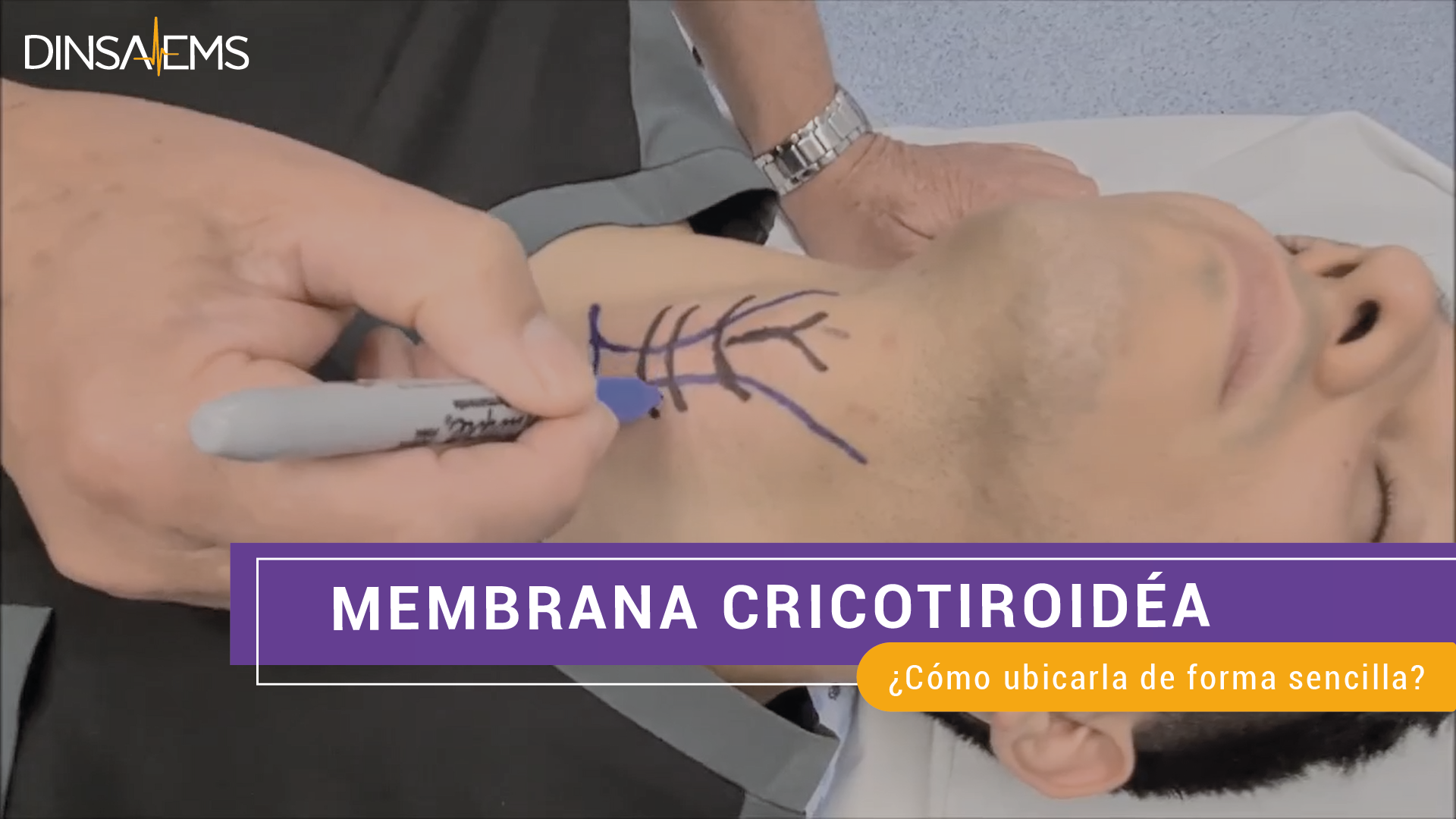 ¿CÓMO UBICAR LA MEMBRANA CRICOTIROIDÉA? | FÁCIL Y RAPIDO