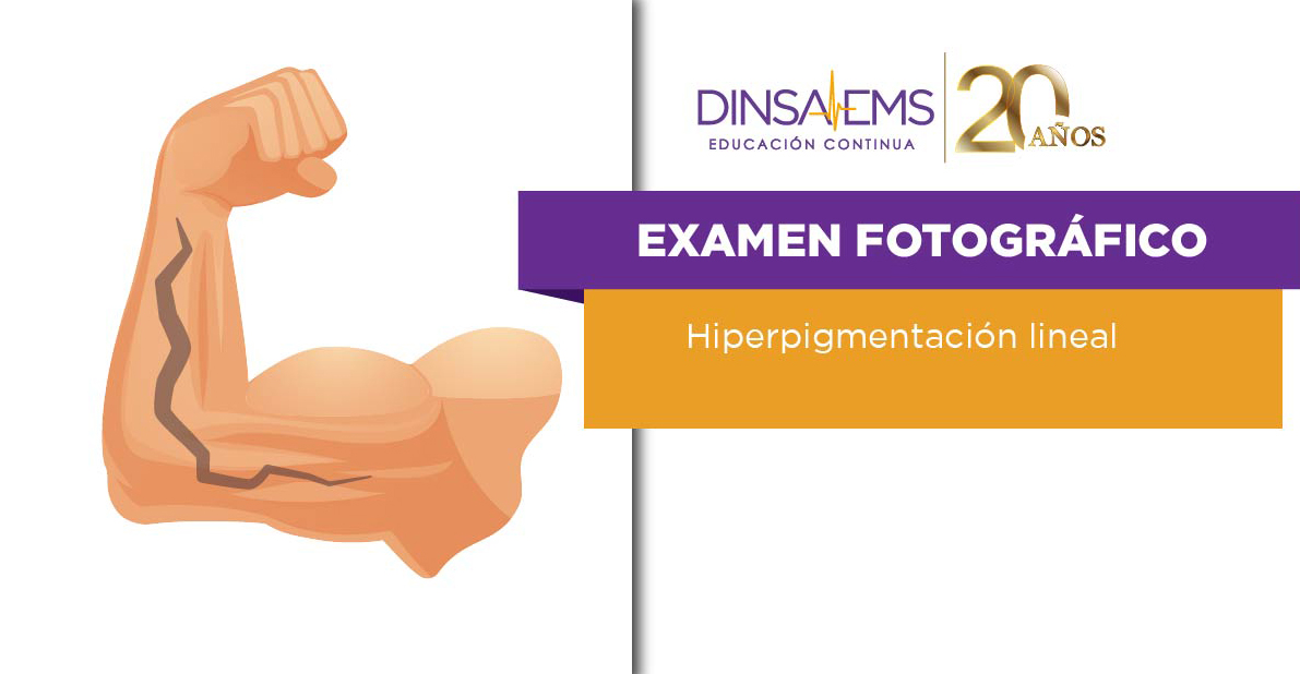 Examen Fotográfico Hiperpigmentación Lineal