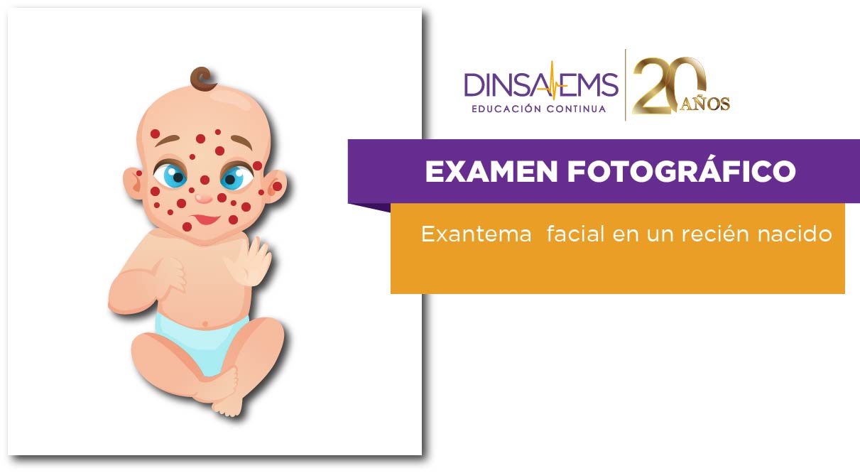 Examen Fotográfico Exantema facial en un recién nacido