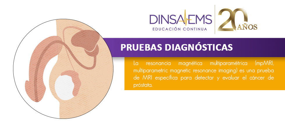 MRI multiparamétrica para la evaluación del cáncer de próstata