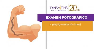 Examen Fotográfico Hiperpigmentación Lineal