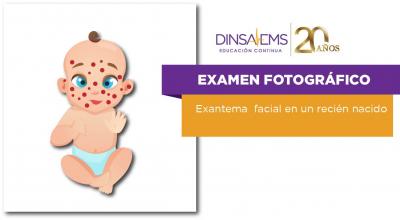 Examen Fotográfico Exantema facial en un recién nacido