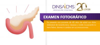 Borramiento del ángulo costofrénico en una paciente con pancreatitis