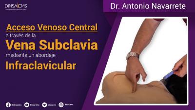 Acceso Venoso Central a través de la Vena Subclavia Mediante un Abordaje Infraclavicular