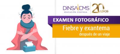 Fiebre y exantema después de un viaje